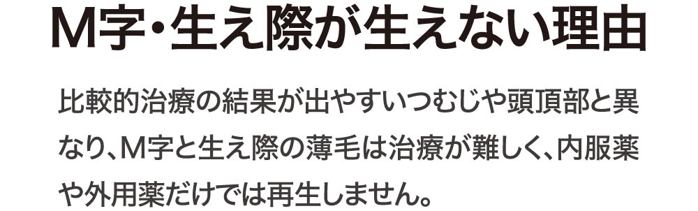 M字・生え際が生えない理由 比較的治療の結果が出やすいつむじや頭頂部と異なり、M字と生え際の薄毛は治療が難しく、内服薬や外用薬だけでは再生しません。