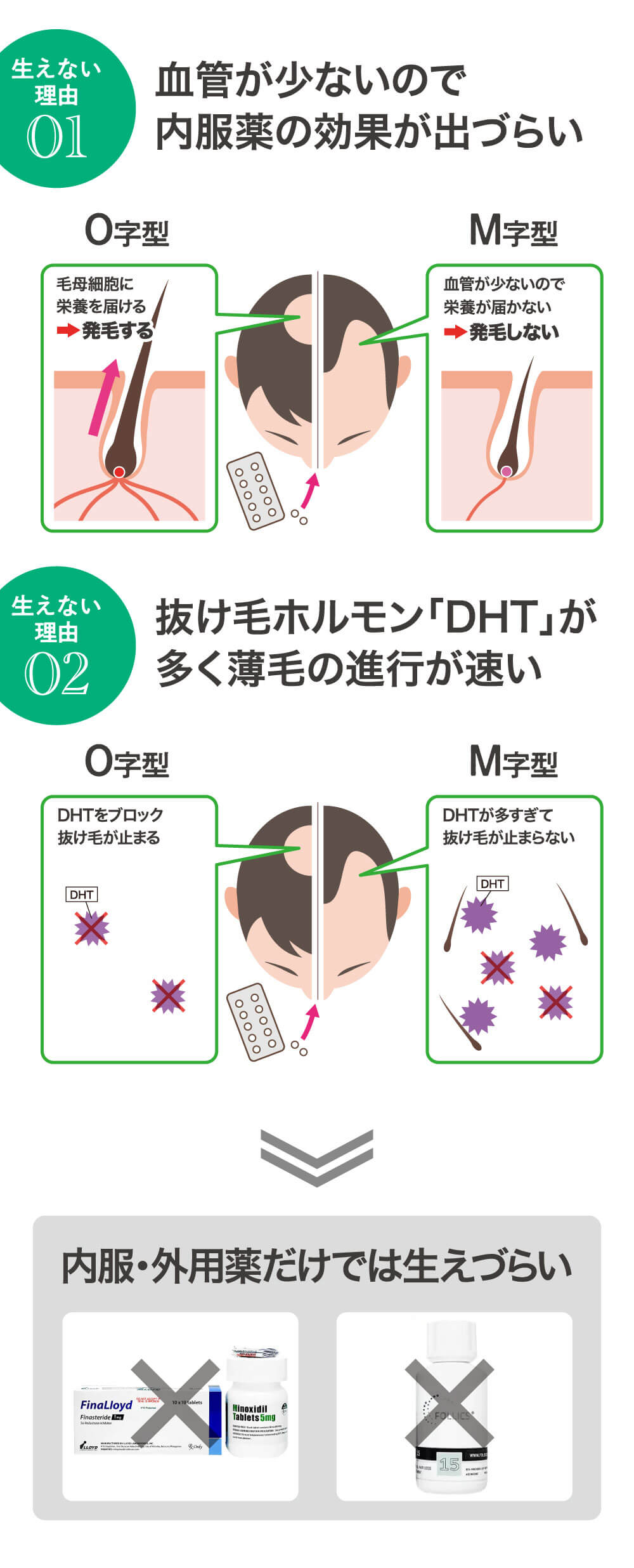 生えない理由01 血管が少ないので内服薬の効果が出づらい 生えない理由02 抜け毛ホルモン「DHT」が多く薄毛の進行が速い 内服・外用薬でM字は生えません