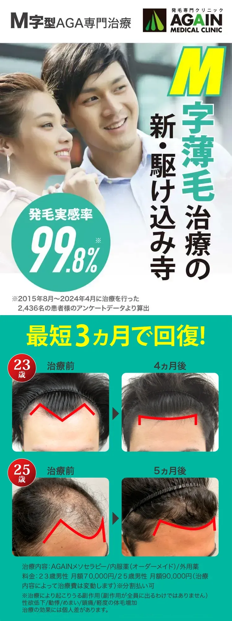 M字型AGA専門治療 発毛専門クリニックAGAIN MEDICAL CLINIC