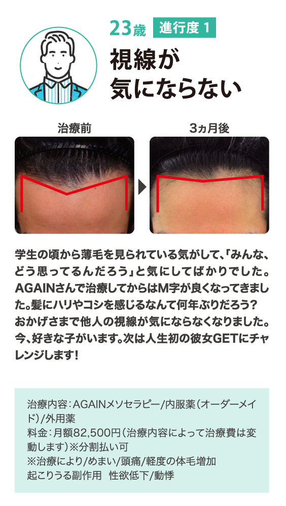 視線が気にならない