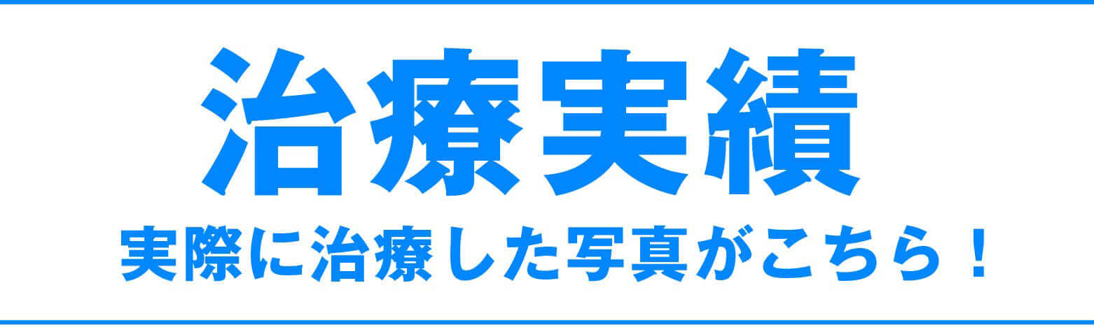 実際に治療した写真がこちら!